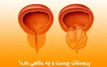 علائم بیماری پروستات چیست؟ / جدول مقایسه پروستات خوش‌ خیم و بدخیم