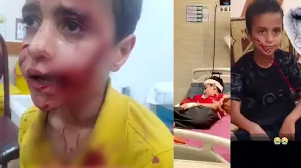 حمله خونین سگ ولگرد به پسر 11 ساله در مسجدسلمیان