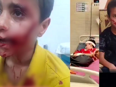 حمله خونین سگ ولگرد به پسر 11 ساله در مسجدسلمیان
