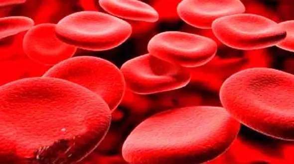 بیماری کم خونی را با 8 نشانه جدی بشناسید