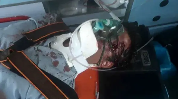 عکس جنازه مرد تهرانی در تصادف خط ویژه / روز گذشته رخ داد