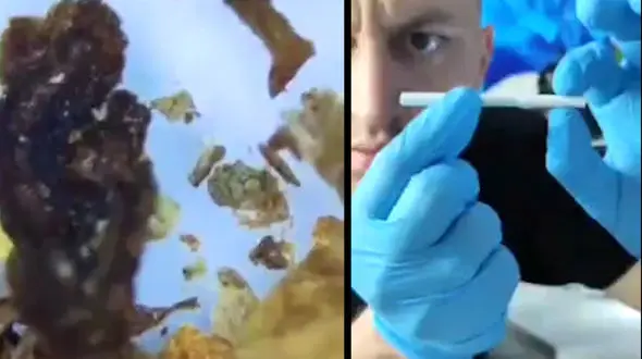 سیگاری ها ببینند / محتویات وحشتناک سیگار زیر میکروسکوپ + فیلم 