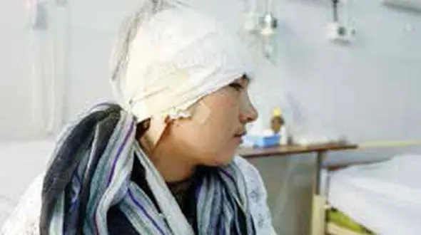 عکس زن جوانی که گوش هایش  را شوهرش برید+جزئیات