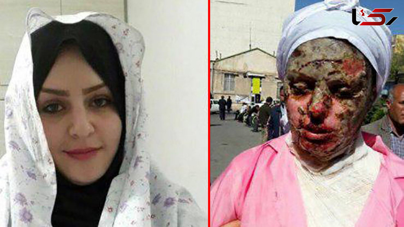 ترسناک ترین و بی رحم ترین خواستگار ایران در زندان تبریز ! + عکس دختر سوخته