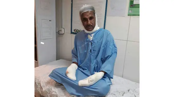 اولین عکس از آتش‌نشان فداکار اهوازی با بدن سوخته + تصویر
