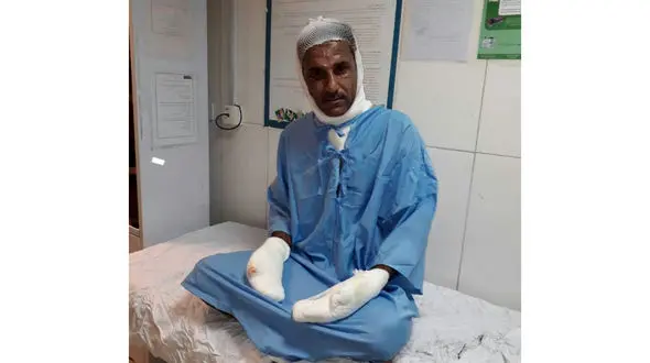 اولین عکس از آتش‌نشان فداکار اهوازی با بدن سوخته + تصویر