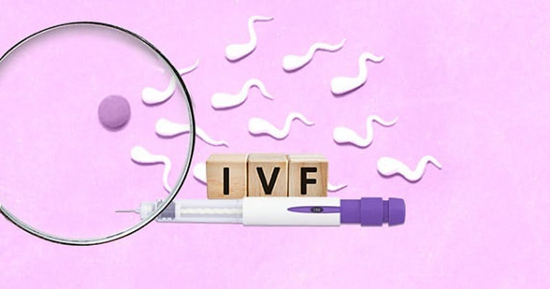 آی وی اف Ivf چیست؟ 