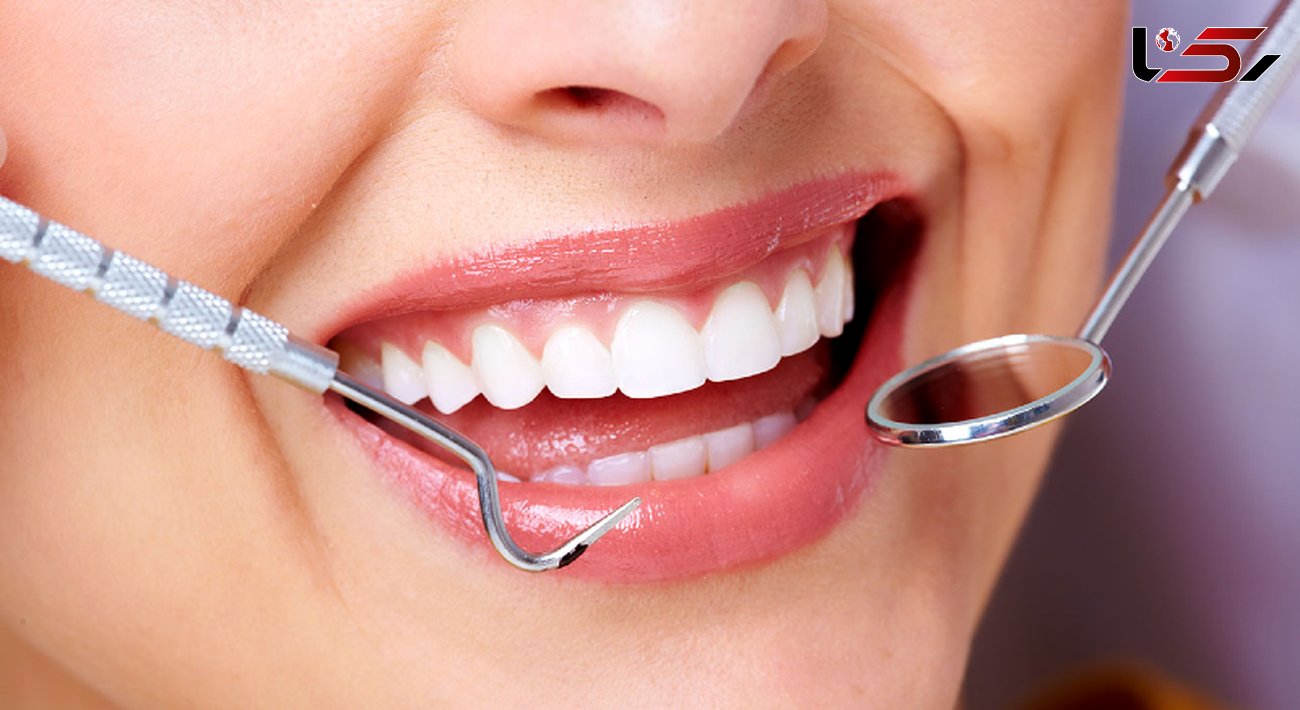 درمان لکه‌های سفید دندانی با یک ماده ارزان قیمت