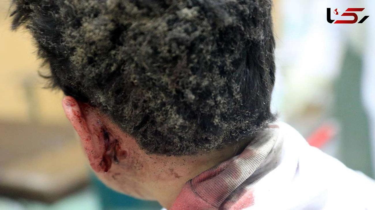 نوجوان 16 ساله همدانی قربانی چهارشنبه سوری شد