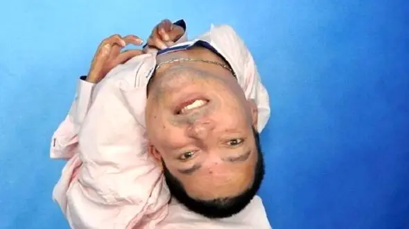 کله این مرد  وارونه روی سرش است !  + عکس ها و سرنوشت جگرسوز باورنکردنی