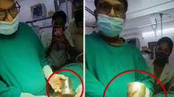 کشف لیوان فولادی در معده یک مرد / پزشک هندی شوکه شد + عکس