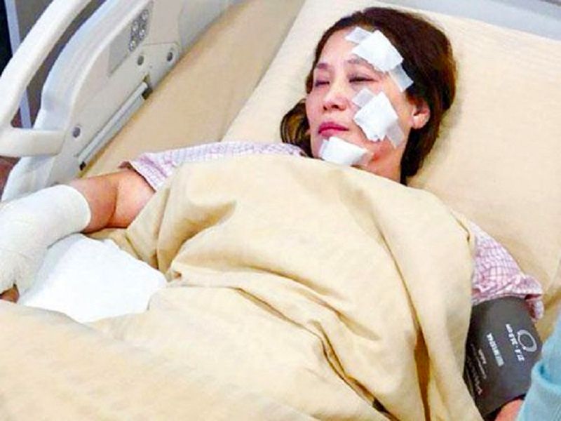 لحظه ی وحشتناک سوختن 31 بازیگر زن و مرد در سر صحنه فیلمبرداری