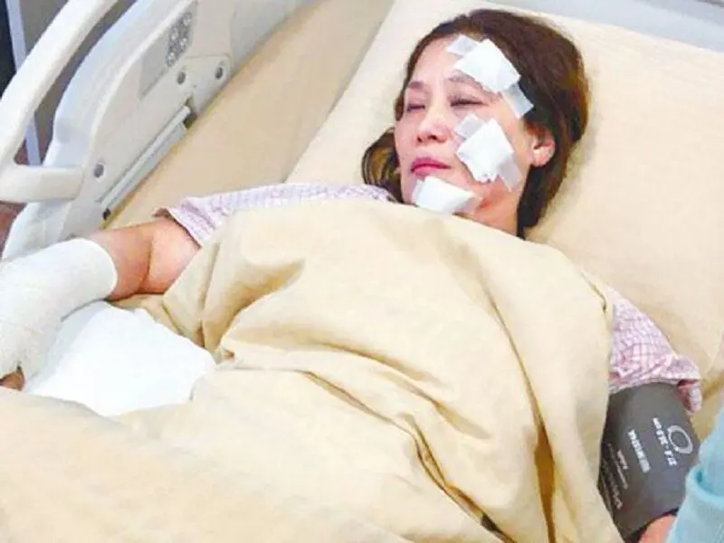 لحظه ی وحشتناک سوختن 31 بازیگر زن و مرد در سر صحنه فیلمبرداری