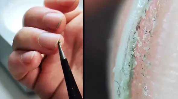 راز چندشناک در دل ناخن ها+ فیلم