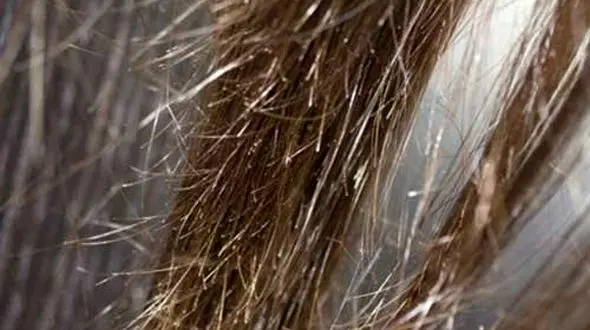  جنگ با موخوره با ساده ترین رژیم غذایی