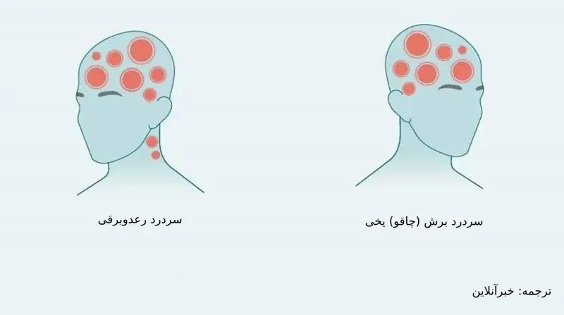 درد در نواحی مختلف سر ناشی از چیست؟/ از سردرد خوشه‌ای تا سردرد رعد و برقی+ تصاویر