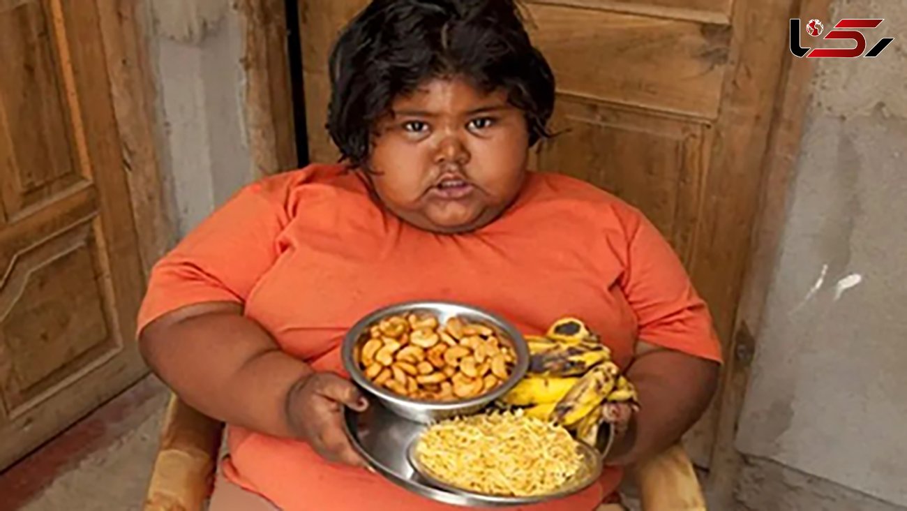 عکس دختر 9 ساله که روزی 14 کیلو برنج می خورد /  180 موز در یک روز !