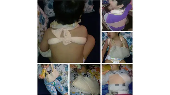 تعطیلی مهد کودک متخلف در حادثه بدرفتاری با کودک سه ساله+ عکس