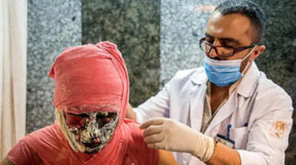 3 قطع عضو، 6 کشته و 4  آسیب دیدگی چشم تا این لحظه در چهارشنبه سوری