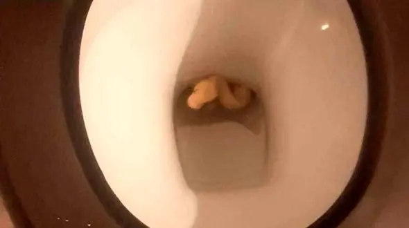 عکس مار خطرناک در توالت فرنگی / زن انگلیسی از توالت فرار کرد