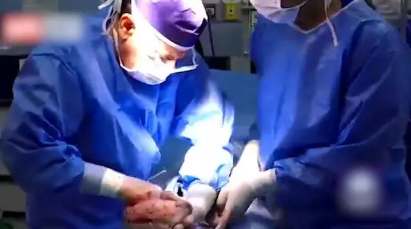 تولد عجیب ترین نوزاد در اصفهان /  این جنین 12 سال فریز بود + فیلم