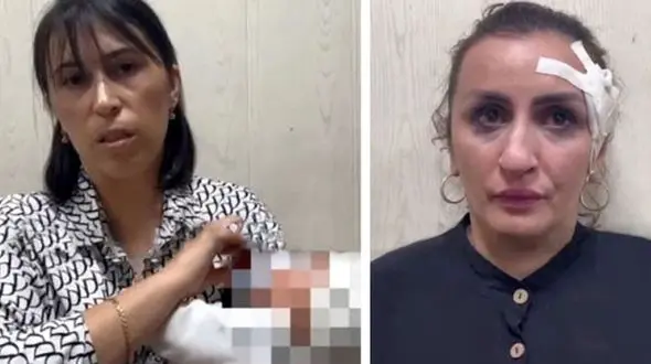 مادری نوزاد 5 روزه اش را برای عمل زیبایی بینی فروخت + عکس 