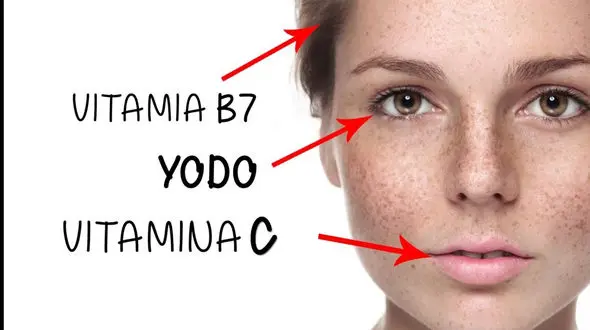 علائم کمبود ویتامین 