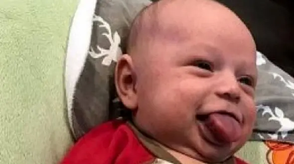 زبان این بچه هر روز درازتر می شود + عکس 