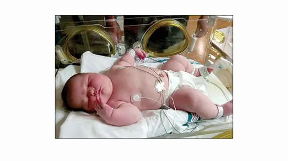 پنجمین نوزاد یک خانواده 6 کیلویی از آب درآمد!