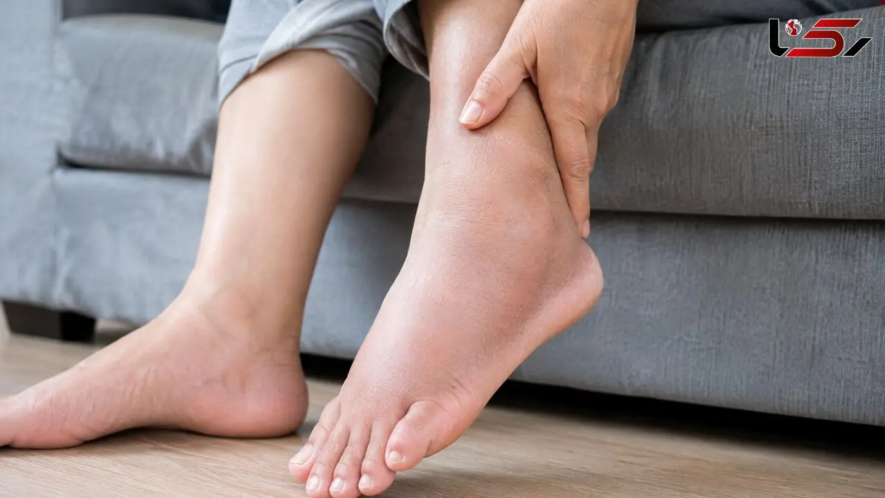 ورم پا و مچ پا نشانه چیست؟ علائمی که نباید نادیده بگیرید