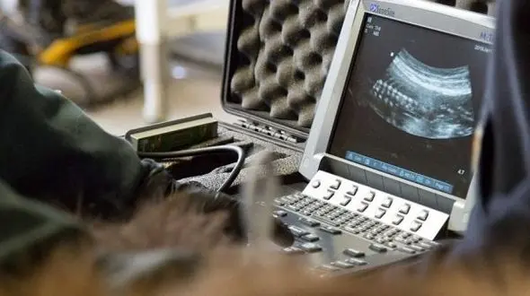 نوزادان نارس با این تست تشخیص داده می شوند