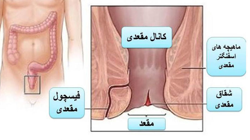 درد مخرج