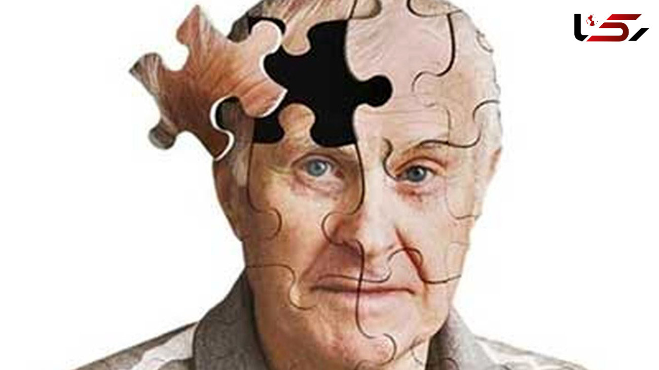 کشف راه درمان سکته مغزی و آلزایمر 