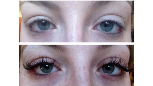 درباره ی کاشت مژه چه می دانید؟ +عکس 