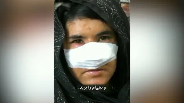 بریدن بینی زن افغان توسط شوهر بدبین+ فیلم دردناک که جهان را تکان داد
