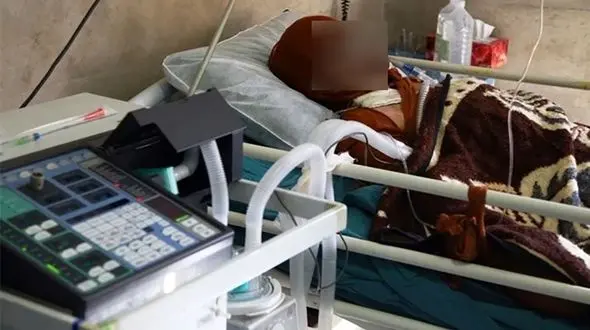 کمبود بیش از ۱۰۰۰ تخت سوختگی در کشور /سوختگی در ایران ۸ برابر آمار جهانی/هرچقدر فقر بیشتر باشد سوختگی بیشتر می‌شود