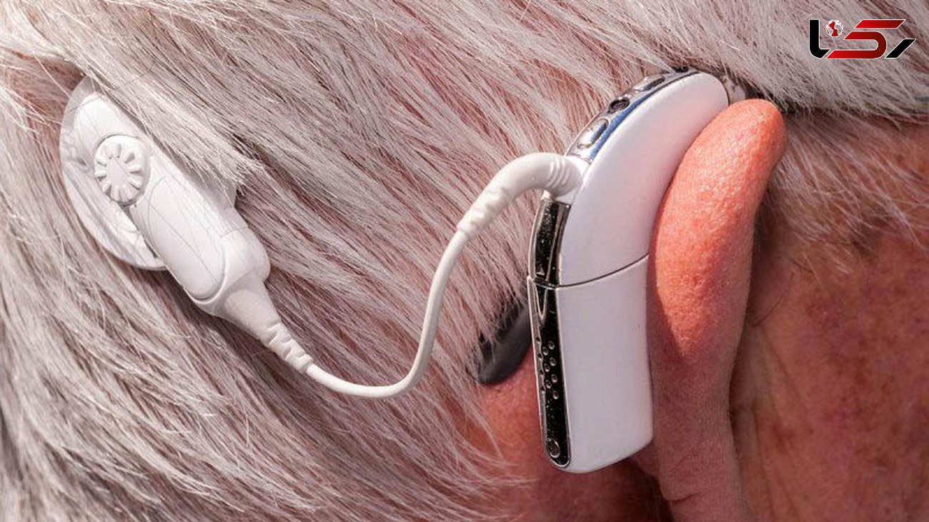 روشی نوین در درمان ناشنوایان/پالس های نوری اعصاب شنوایی را تحریک می کنند