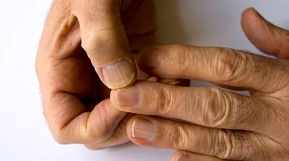 زنگ خطر دیابت با تغییر ناخن ها