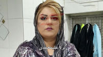مرد سقزی دست و پای زنش را بست و با ریختن بنزین آتشش زد + عکس ثریا علیمحمدی