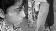 سرنوشت دردناک دختر 11 ساله در خانه جهنمی + عکس