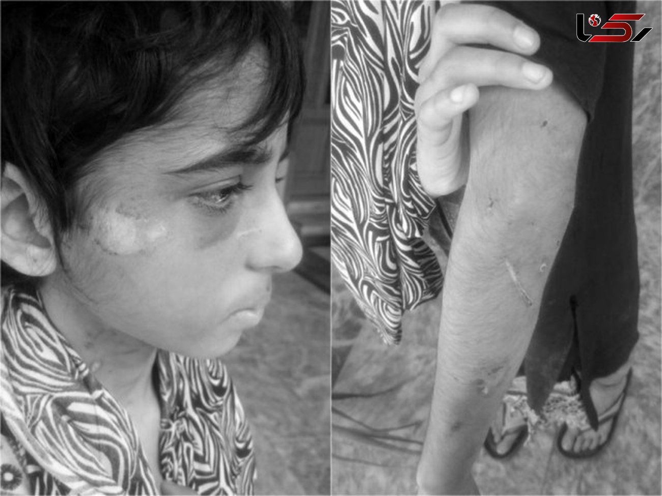 سرنوشت دردناک دختر 11 ساله در خانه جهنمی + عکس