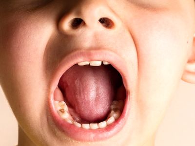 ارتباط سلامت دندان‌ های شیری با رشد کودک؛ نکاتی که نمی‌ دانید