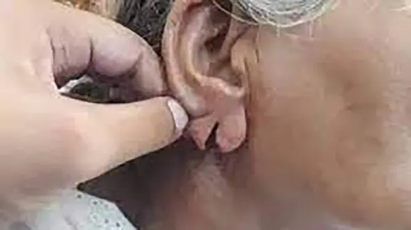 پاره شدن گوش زن تهرانی در حمله وحشیانه مرد گلفروش + عکس تلخ