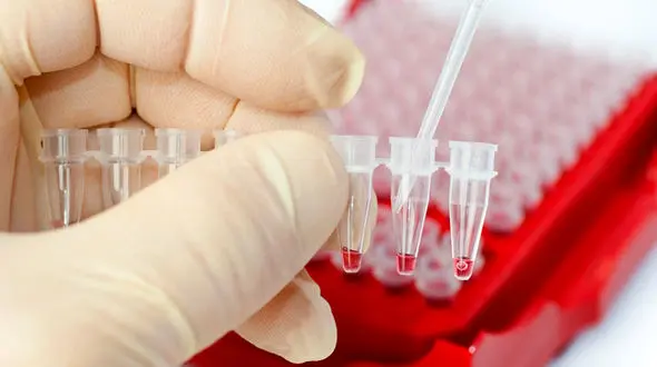 نشانه های کم خونی و فقر آهن در بدن