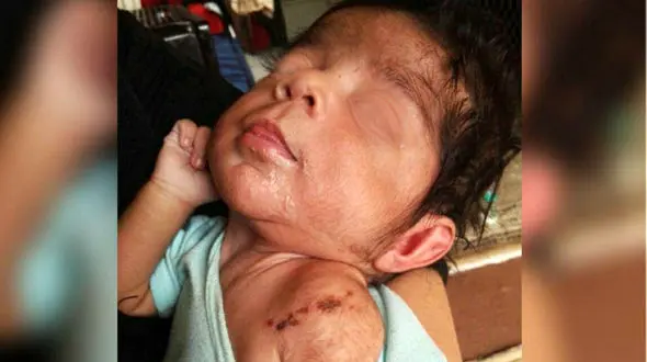 سرنوشت هدی 5 ماهه اشک تان را در می آورد /  پدر و مادرش مانند کفتار به جانش می افتادند + عکس