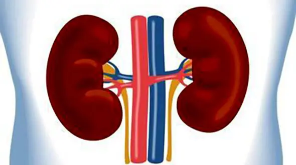 ۷ ماده غذایی مضر برای کلیه ها