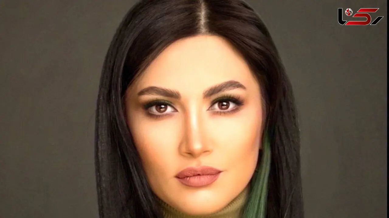  عکس سمیرا حسینی قبل از عمل زیبایی لورفت / سمیرا حسینی چی بود و چی شد! 