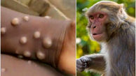 غربالگری ۸۱ نمونه مشکوک آبله میمون در انستیتو پاستور / هنوز نمونه مثبتی از آبله میمون در ایران شناسایی نشده است