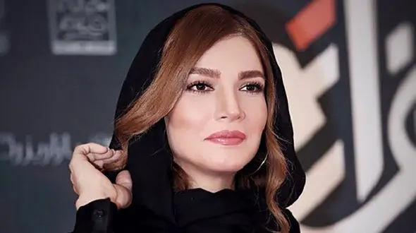 سگی که جان خانم بازیگر است +عکس