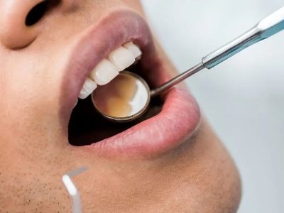 چگونه استرس به آرامی دندان‌ های شما را از بین می‌ برد؟